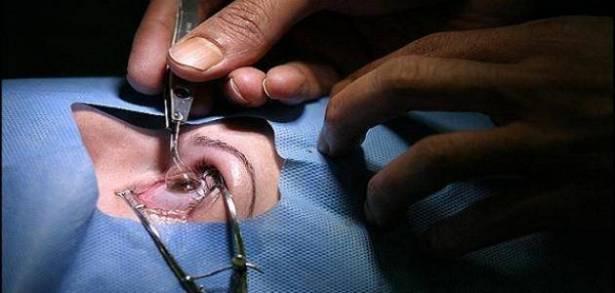 جراحات العيون